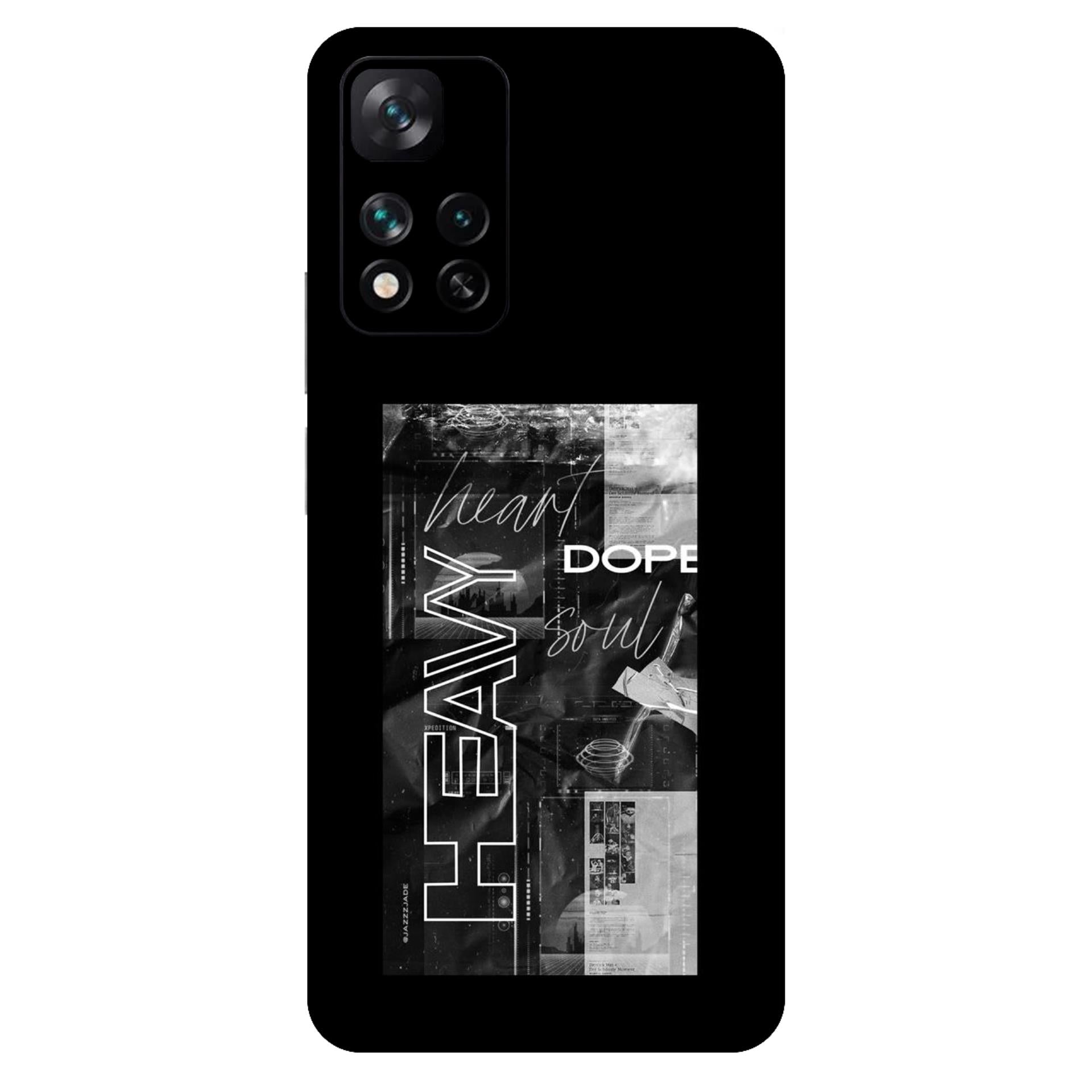 Xiaomi 11i 5G Skins & Wraps